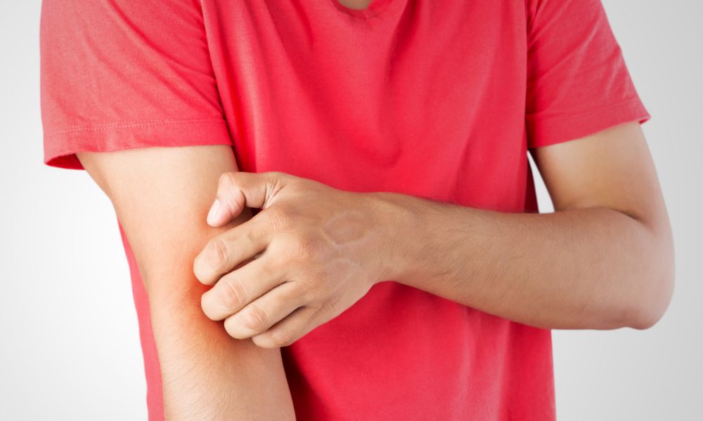 Szappan ekcémás bőrre - Miért számít ennyire, hogy mivel mosakszunk?